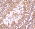 Bax Antibody in Immunohistochemistry (Paraffin) (IHC (P))