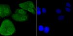 DDB1 Antibody in Immunocytochemistry (ICC/IF)