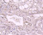 NFIB Antibody in Immunohistochemistry (Paraffin) (IHC (P))