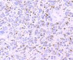 Tyrosinase Antibody in Immunohistochemistry (Paraffin) (IHC (P))