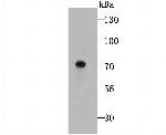 Tyrosinase Antibody in Western Blot (WB)