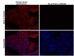 beta-3 Tubulin Antibody in Immunohistochemistry (Paraffin) (IHC (P))