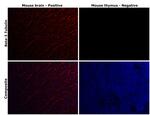 beta-3 Tubulin Antibody in Immunohistochemistry (Paraffin) (IHC (P))