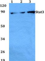 STAT3 Antibody in Western Blot (WB)