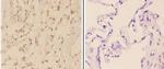 c-Abl Antibody in Immunohistochemistry (Paraffin) (IHC (P))