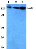 c-Abl Antibody in Western Blot (WB)