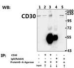 CD30 Antibody in Immunoprecipitation (IP)