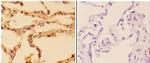 SQSTM1 Antibody in Immunohistochemistry (Paraffin) (IHC (P))