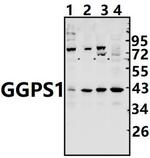 GGPS1 Antibody in Western Blot (WB)