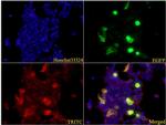 ATG5 Antibody in Immunocytochemistry (ICC/IF)