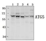 ATG5 Antibody in Western Blot (WB)