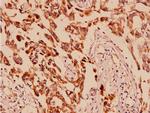 AMPK alpha-1 Antibody in Immunohistochemistry (Paraffin) (IHC (P))