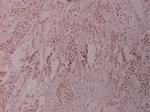 ATF2 Antibody in Immunohistochemistry (Paraffin) (IHC (P))