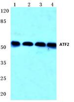 ATF2 Antibody in Western Blot (WB)