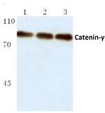 gamma Catenin Antibody in Western Blot (WB)