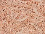 COX2 Antibody in Immunohistochemistry (Paraffin) (IHC (P))