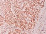 CAS Antibody in Immunohistochemistry (Paraffin) (IHC (P))