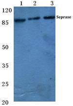 FAP Antibody in Western Blot (WB)