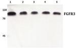 FGFR3 Antibody in Western Blot (WB)