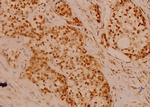 Filamin A Antibody in Immunohistochemistry (Paraffin) (IHC (P))