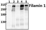 Filamin A Antibody in Western Blot (WB)