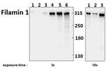 Filamin A Antibody in Western Blot (WB)