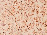 CHOP Antibody in Immunohistochemistry (Paraffin) (IHC (P))