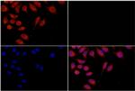 Galectin 3 Antibody in Immunocytochemistry (ICC/IF)