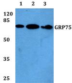 HSPA9 Antibody in Western Blot (WB)