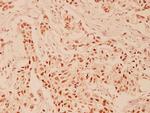 HDAC6 Antibody in Immunohistochemistry (Paraffin) (IHC (P))