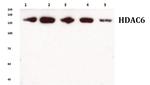 HDAC6 Antibody in Western Blot (WB)