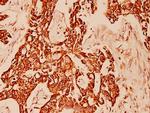 Cytokeratin 10 Antibody in Immunohistochemistry (Paraffin) (IHC (P))