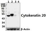 Cytokeratin 20 Antibody in Western Blot (WB)