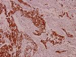 Cytokeratin 8 Antibody in Immunohistochemistry (Paraffin) (IHC (P))