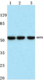 Cytokeratin 8 Antibody in Western Blot (WB)