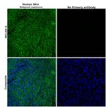 Melan-A Antibody in Immunohistochemistry (Paraffin) (IHC (P))