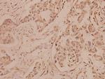 Melan-A Antibody in Immunohistochemistry (Paraffin) (IHC (P))