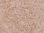 MCL-1 Antibody in Immunohistochemistry (Paraffin) (IHC (P))