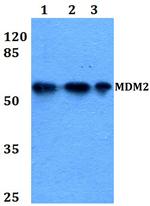 MDM2 Antibody in Western Blot (WB)