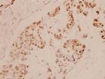 MEF2A Antibody in Immunohistochemistry (Paraffin) (IHC (P))