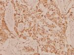 MEK3 Antibody in Immunohistochemistry (Paraffin) (IHC (P))