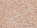 MMP19 Antibody in Immunohistochemistry (Paraffin) (IHC (P))