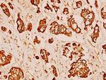 MMP3 Antibody in Immunohistochemistry (Paraffin) (IHC (P))