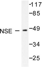 NSE Antibody in Western Blot (WB)