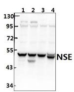 NSE Antibody in Western Blot (WB)