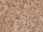 PDGF-B Antibody in Immunohistochemistry (Paraffin) (IHC (P))