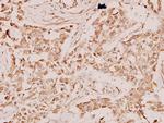 RAN Antibody in Immunohistochemistry (Paraffin) (IHC (P))