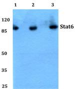 STAT6 Antibody in Western Blot (WB)