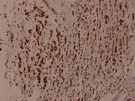 WNK1 Antibody in Immunohistochemistry (Paraffin) (IHC (P))