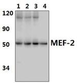 MEF2A Antibody in Western Blot (WB)